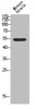 Western blot analysis of mouse-brain using TASK-1 antibody. Antibody was diluted at 1:500. Secondary antibody was diluted at 1:20000