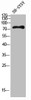 Western blot analysis of SH-SY5Y lysis using HGF antibody. Antibody was diluted at 1:500. Secondary antibody was diluted at 1:20000