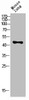 Western blot analysis of mouse-lung lysis using KIR3DL1 antibody. Antibody was diluted at 1:1000. Secondary antibody was diluted at 1:20000