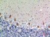 Immunohistochemical analysis of paraffin-embedded human-brain, antibody was diluted at 1:100