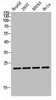 Western blot analysis of HepG2 293T AD293 Hela lysis using TDGF1P3 antibody. Antibody was diluted at 1:1000. Secondary antibody was diluted at 1:20000