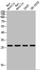 Western blot analysis of RAT-MUSLE RAT-SPLEEN 293T SH-SY5Y using IL26 antibody. Antibody was diluted at 1:2000. Secondary antibody was diluted at 1:20000