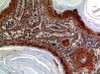 Immunohistochemical analysis of paraffin-embedded human-skin, antibody was diluted at 1:100