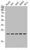 Western blot analysis of HepG2 823-AV 293T AD293 Hela lysis using PGLYRP1 antibody. Antibody was diluted at 1:1000. Secondary antibody was diluted at 1:20000