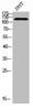 Western blot analysis of 293T using Acetyl-RIP140 (K158) antibody. Antibody was diluted at 1:500. Secondary antibody was diluted at 1:20000