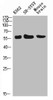 Western Blot analysis of K562 SH-SY5Y mouse-brain cells using E-Selectin Polyclonal Antibody diluted at 1:500. Secondary antibody was diluted at 1:20000