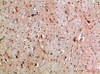 Immunohistochemical analysis of paraffin-embedded human-brain, antibody was diluted at 1:200