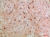 Immunohistochemical analysis of paraffin-embedded human-brain, antibody was diluted at 1:200