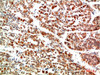 Immunohistochemical analysis of paraffin-embedded Human Stomach Tissue using IkB α Rabbit pAb diluted at 1:200