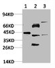 Western blot analysis of 1) Hela Cell Lysate, 2) PC12 Cell Lysate, 3) 3T3 Cell Lysate using IkB α Rabbit pAb diluted at 1:1000.