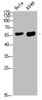 Western blot analysis of HELA A549 Cell Lysate, antibody was diluted at 1:1000. Secondary antibody was diluted at 1:20000