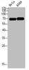 Western blot analysis of HELA A549 Cell Lysate, antibody was diluted at 1:1000. Secondary antibody was diluted at 1:20000
