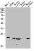 Western blot analysis of Jurkat U937 Raji mouse-eye lysate, antibody was diluted at 1000. Secondary antibody was diluted at 1:20000