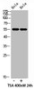 Western blot analysis of mouse-lung mouse-kidney mouse-liver lysate, antibody was diluted at 500. Secondary antibody was diluted at 1:20000