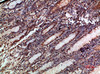 Immunohistochemical analysis of paraffin-embedded human-stomach, antibody was diluted at 1:200