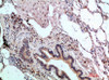 Immunohistochemical analysis of paraffin-embedded human-lung, antibody was diluted at 1:200