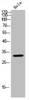 Western blot analysis of 293T Hela lysate, antibody was diluted at 2000. Secondary antibody was diluted at 1:20000