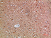 Immunohistochemical analysis of paraffin-embedded human-brain, antibody was diluted at 1:200