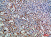 Immunohistochemical analysis of paraffin-embedded human-spleen, antibody was diluted at 1:200