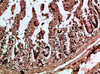 Immunohistochemical analysis of paraffin-embedded human-colon, antibody was diluted at 1:200