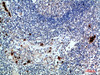 Immunohistochemical analysis of paraffin-embedded human-lymph, antibody was diluted at 1:200