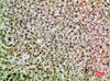Immunohistochemical analysis of paraffin-embedded human-liver, antibody was diluted at 1:200