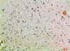 Immunohistochemical analysis of paraffin-embedded Human-brain, antibody was diluted at 1:100