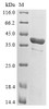 (Tris-Glycine gel) Discontinuous SDS-PAGE (reduced) with 5% enrichment gel and 15% separation gel. (Tris-Glycine gel) Discontinuous SDS-PAGE (reduced) with 5% enrichment gel and 15% separation gel.