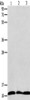 Gel: 12%SDS-PAGE, Lysate: 40 μg, Lane 1-3: Jurkat cells, K562 cells, Raji cells, Primary antibody: CSB-PA445027 (RPS27 Antibody) at dilution 1/350, Secondary antibody: Goat anti rabbit IgG at 1/8000 dilution, Exposure time: 10 seconds