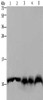 Gel: 10%SDS-PAGE, Lysate: 40 μg, Lane 1-5: Mouse pancreas tissue, Hela cells, mouse liver tissue, A549 cells, 293T cells, Primary antibody: CSB-PA179850 (UBB Antibody) at dilution 1/500, Secondary antibody: Goat anti rabbit IgG at 1/8000 dilution, Exposure time: 20 seconds