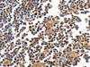 The image on the left is immunohistochemistry of paraffin-embedded Human tonsil tissue using CSB-PA059198 (MAGEA4 Antibody) at dilution 1/20, on the right is treated with fusion protein. (Original magnification: ×200)