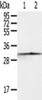 Gel: 10%SDS-PAGE, Lysate: 40 μg, Lane 1-2: Jurkat cells, 293T cells, Primary antibody: CSB-PA984107 (CASP3 Antibody) at dilution 1/300 dilution, Secondary antibody: Goat anti rabbit IgG at 1/8000 dilution, Exposure time: 10 seconds