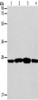 Gel: 12%SDS-PAGE, Lysate: 40 μg, Lane 1-4: Jurkat cells, A431 cells, A549 cells, A375 cells, Primary antibody: CSB-PA168017 (CASP14 Antibody) at dilution 1/350, Secondary antibody: Goat anti rabbit IgG at 1/8000 dilution, Exposure time: 10 seconds