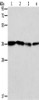Gel: 10%SDS-PAGE, Lysate: 40 μg, Lane 1-4: Hela cells, Jurkat cells, 293T cells, K562 cells, Primary antibody: CSB-PA178504 (NFKBIA Antibody) at dilution 1/84, Secondary antibody: Goat anti rabbit IgG at 1/8000 dilution, Exposure time: 10 seconds