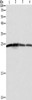 Gel: 12%SDS-PAGE, Lysate: 40 μg, Lane 1-4: Hela cells, A431 cells, 293T cells, Jurkat cells, Primary antibody: CSB-PA299203 (BAK1 Antibody) at dilution 1/550, Secondary antibody: Goat anti rabbit IgG at 1/8000 dilution, Exposure time: 5 seconds