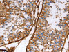 The image on the left is immunohistochemistry of paraffin-embedded Human testis tissue using CSB-PA437587 (CALD1 Antibody) at dilution 1/40, on the right is treated with fusion protein. (Original magnification: ×200)