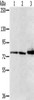 Gel: 6%SDS-PAGE, Lysate: 40 μg, Lane 1-3: Mouse heart tissue, HT29 cells, mouse liver tissue, Primary antibody: CSB-PA346002 (CAPN7 Antibody) at dilution 1/300, Secondary antibody: Goat anti rabbit IgG at 1/8000 dilution, Exposure time: 1 second