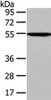 Gel: 8%SDS-PAGE, Lysate: 40 μg, Lane: Mouse liver tissue, Primary antibody: CSB-PA783286 (CAMK1G Antibody) at dilution 1/250 dilution, Secondary antibody: Goat anti rabbit IgG at 1/8000 dilution, Exposure time: 1MIN