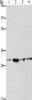 Gel: 8%SDS-PAGE, Lysate: 40 μg, Lane 1-4: A431 cells, 231 cells, hela cells, human fetal liver tissue, Primary antibody: CSB-PA267352 (CDK2 Antibody) at dilution 1/250, Secondary antibody: Goat anti rabbit IgG at 1/8000 dilution, Exposure time: 1 minute