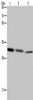 Gel: 10+12%SDS-PAGE, Lysate: 30 μg, Lane 1-2: Human fetal brain tissue, Human colon cancer tissue, Primary antibody: CSB-PA280305 (CDK5 Antibody) at dilution 1/150, Secondary antibody: Goat anti rabbit IgG at 1/8000 dilution, Exposure time: 5 minutes