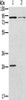 Gel: 8%SDS-PAGE, Lysate: 40 μg, Lane 1-2: Mouse kidney tissue, Mouse brain tissue, Primary antibody: CSB-PA292433 (CNGA3 Antibody) at dilution 1/500, Secondary antibody: Goat anti rabbit IgG at 1/8000 dilution, Exposure time: 2 minutes