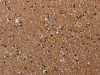 The image on the left is immunohistochemistry of paraffin-embedded Human brain tissue using CSB-PA144936 (CLDND1 Antibody) at dilution 1/40, on the right is treated with fusion protein. (Original magnification: ×200) The image on the left is immunohistochemistry of paraffin-embedded Human brain tissue using CSB-PA144936 (CLDND1 Antibody) at dilution 1/40, on the right is treated with fusion protein. (Original magnification: ×200)