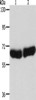 Gel: 8%SDS-PAGE, Lysate: 40 μg, Lane 1-2: Human fetal liver tissue, Human brain tissue, Primary antibody: CSB-PA283874 (CYP1B1 Antibody) at dilution 1/250, Secondary antibody: Goat anti rabbit IgG at 1/8000 dilution, Exposure time: 30 seconds