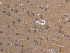 The image on the left is immunohistochemistry of paraffin-embedded Human brain tissue using CSB-PA563111 (CYP3A4 Antibody) at dilution 1/40, on the right is treated with fusion protein. (Original magnification: ×200)