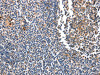 The image on the left is immunohistochemistry of paraffin-embedded Human tonsil tissue using CSB-PA546791 (DEFA1 Antibody) at dilution 1/10, on the right is treated with fusion protein. (Original magnification: ×200)