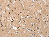 The image on the left is immunohistochemistry of paraffin-embedded Human brain tissue using CSB-PA037884 (DKK3 Antibody) at dilution 1/50, on the right is treated with fusion protein. (Original magnification: ×200)