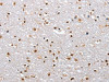 The image on the left is immunohistochemistry of paraffin-embedded Human brain tissue using CSB-PA252158 (ELAVL1 Antibody) at dilution 1/40, on the right is treated with fusion protein. (Original magnification: ×200)