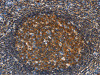 The image on the left is immunohistochemistry of paraffin-embedded Human tonsil tissue using CSB-PA101118 (GNA13 Antibody) at dilution 1/30, on the right is treated with fusion protein. (Original magnification: ×200)