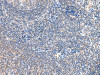 The image on the left is immunohistochemistry of paraffin-embedded Human tonsil tissue using CSB-PA230617 (GRB14 Antibody) at dilution 1/20, on the right is treated with fusion protein. (Original magnification: ×200)