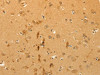 The image on the left is immunohistochemistry of paraffin-embedded Human brain tissue using CSB-PA589025 (CFHR1 Antibody) at dilution 1/40, on the right is treated with fusion protein. (Original magnification: ×200) The image on the left is immunohistochemistry of paraffin-embedded Human brain tissue using CSB-PA589025 (CFHR1 Antibody) at dilution 1/40, on the right is treated with fusion protein. (Original magnification: ×200)